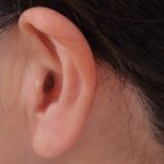 DTMerは耳が命!! 起こりがちな耳のトラブル3例 ～普段の心がけで7割は防げるかも～